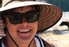 Doctors Amputate Feet of UCSB Student with Meningococcal Disease