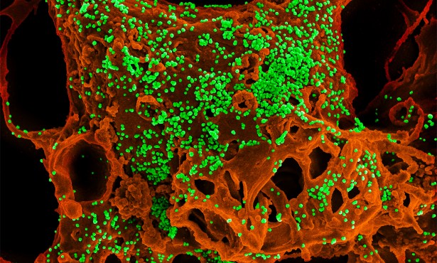 Ventura Reports Second Presumptive Case of COVID-19