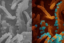 Positive COVID Cases Found at Eight Nursing Homes in Santa Barbara County