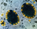 New COVID Variant Evolves and Is Already Global