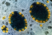 New COVID Variant Evolves and Is Already Global